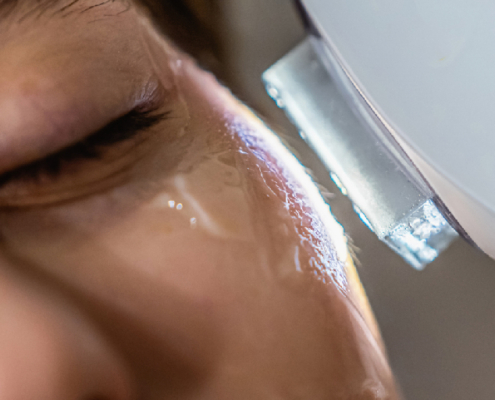 Can You Reverse Sun Damage?
