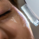 Can You Reverse Sun Damage?