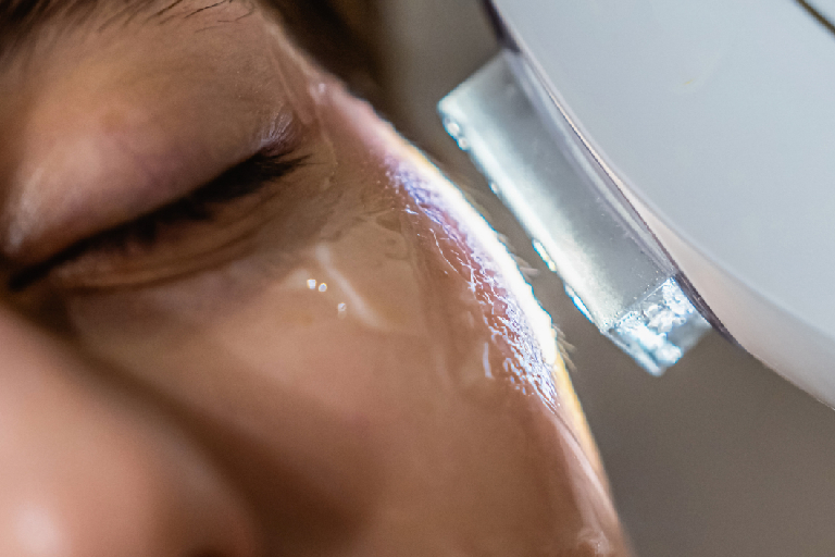 Can You Reverse Sun Damage?