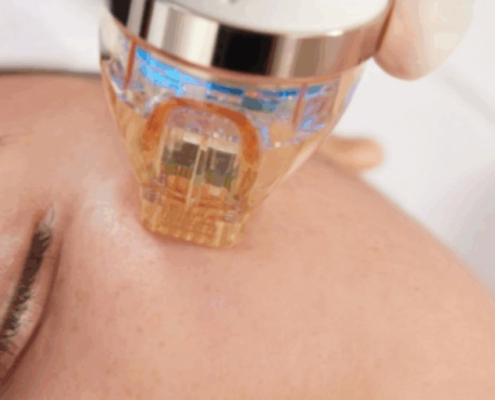 Firm Up Your Facial firmness