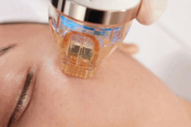 Firm Up Your Facial firmness
