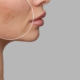 Hyperpigmentation Help: Brighten Up Your Complexion