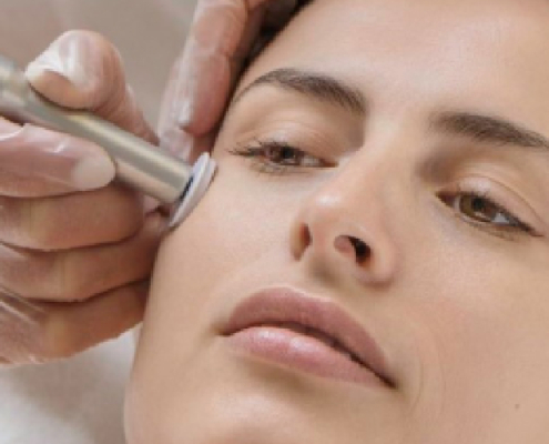 Microneedling Rf Vs. Microchanneling: What’s The Difference?