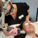 Skin Resurfacing With Helix Coolpeel