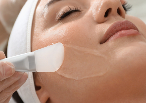 Chemical peel treatment for smoother and brighter skin at Bluffton Aesthetics