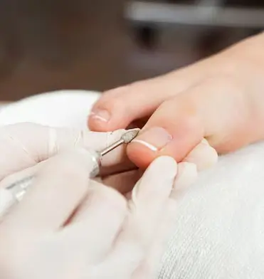Professional nail restoration treatment in a podiatry clinic