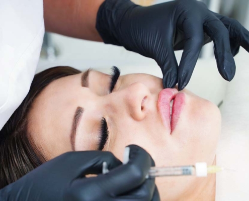 Honolulu lip injection treatment, Oahu lip augmentation, Hawaii.
