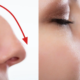 What I Wish I Knew Before Rhinoplasty - Dr. Susan Tan