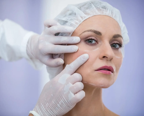 A female patient with surgical markings on her face during a facelift consultation with a Hawaii facial plastic surgeon.