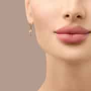 Results of cosmetic lip fillers in Honolulu showcase increased lip volume with improved lip hydration.