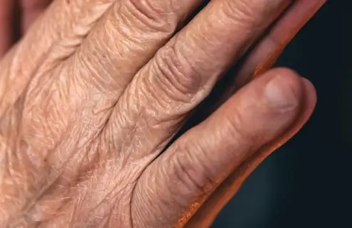 Close-up of deeply wrinkled and crepey skin on an older hand, illustrating the clear need for effective hand rejuvenation to restore youth.