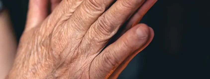 Close-up of deeply wrinkled and crepey skin on an older hand, illustrating the clear need for effective hand rejuvenation to restore youth.