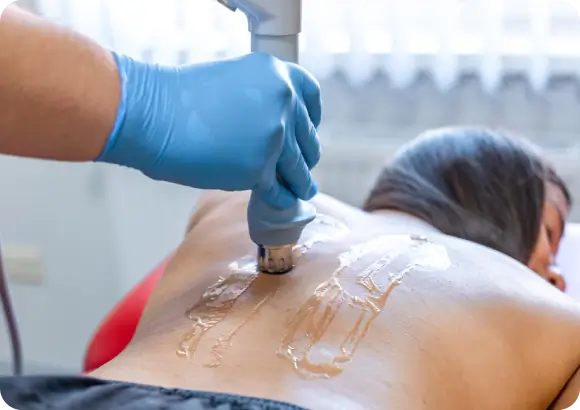Genicular nerve block injection providing knee pain relief without surgery