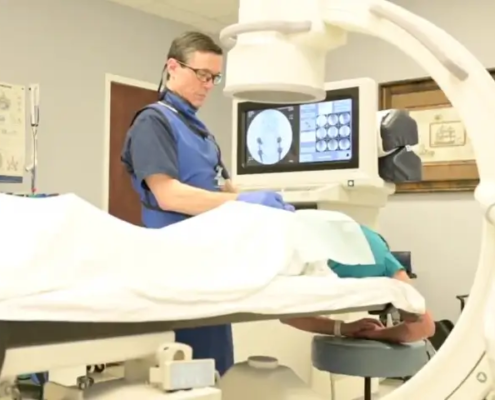 Radiofrequency ablation procedure targeting spinal nerves for chronic pain relief