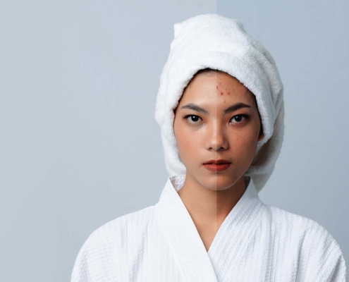 Tips to Make Dermal Filler Last Longer - Dr. Susan Tan