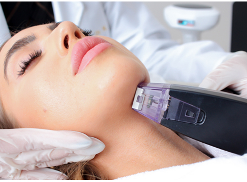 Advance RF microneedling skin treatment with Morpheus8, Oahu, Hawaii.