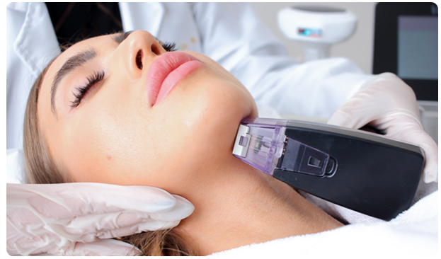 Advance RF microneedling skin treatment with Morpheus8, Oahu, Hawaii.