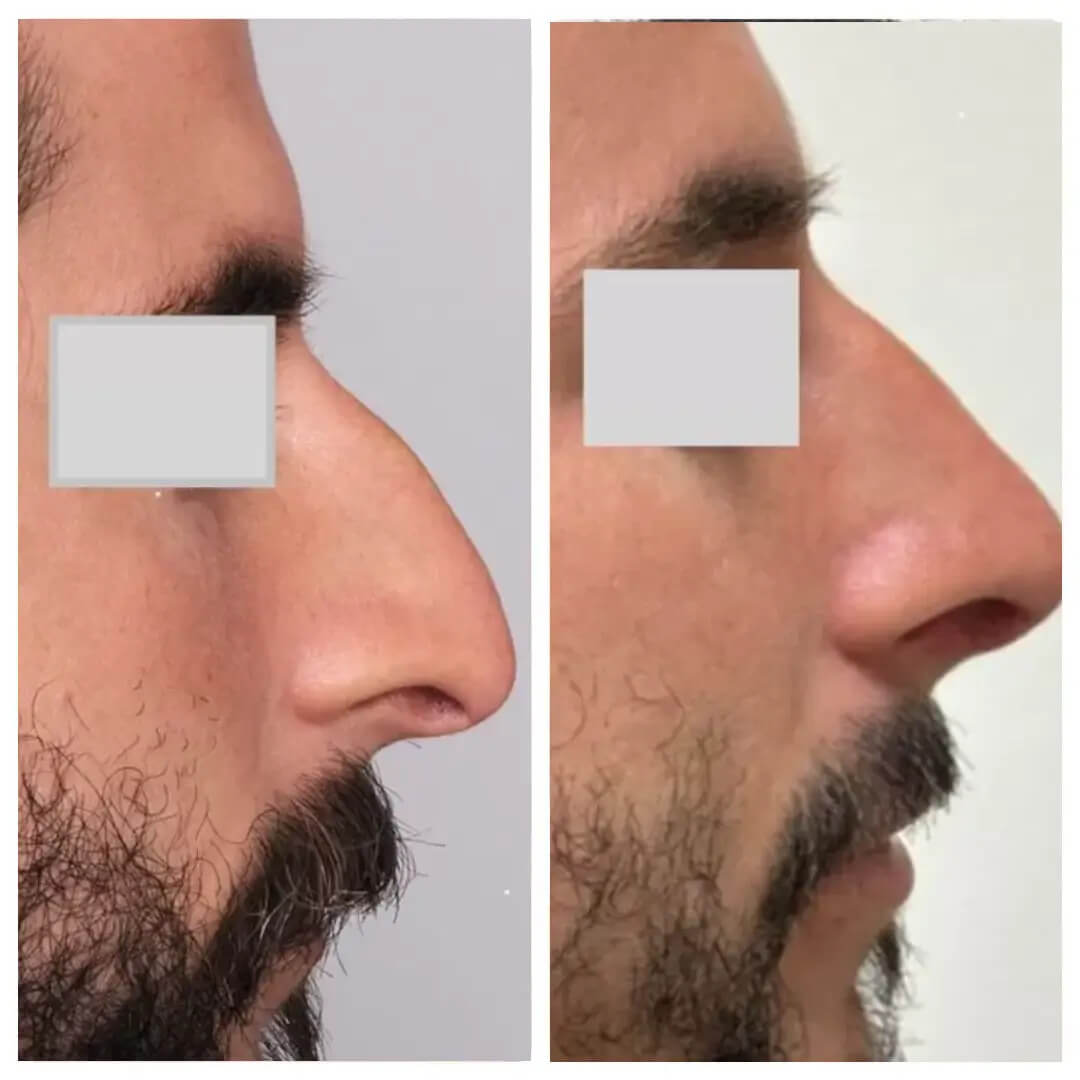 Gallery - Dr Susan Tan | Hawaii Facial Plastic Surgery