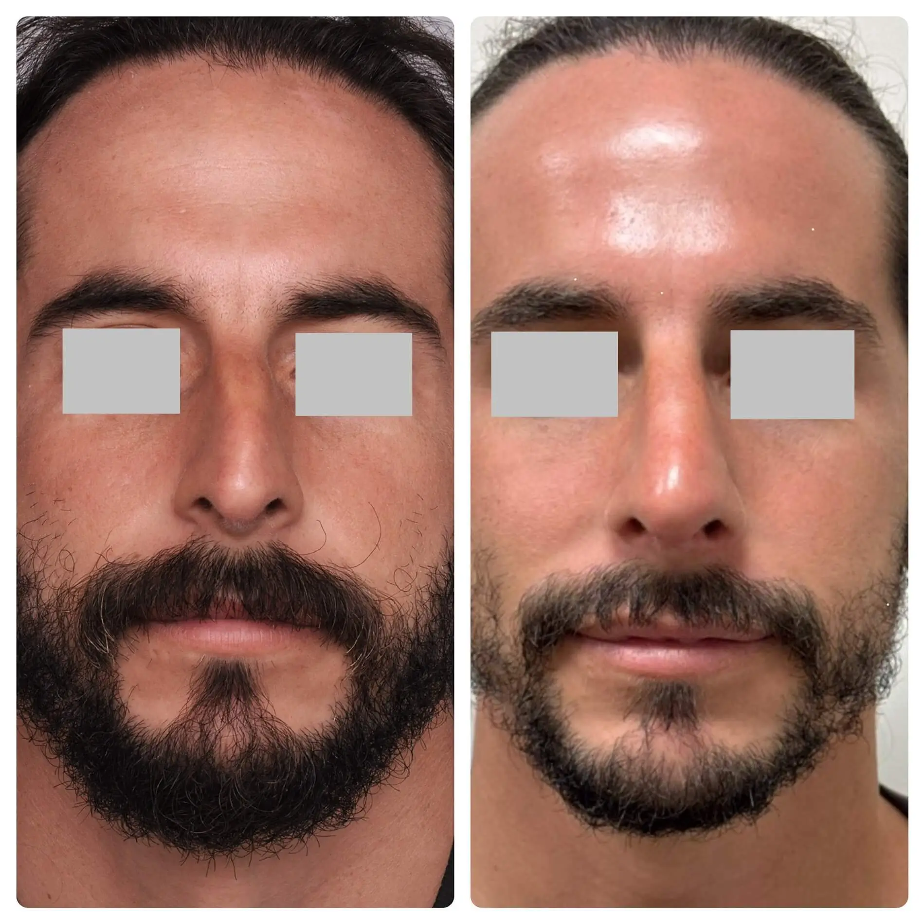 Gallery - Dr Susan Tan | Hawaii Facial Plastic Surgery