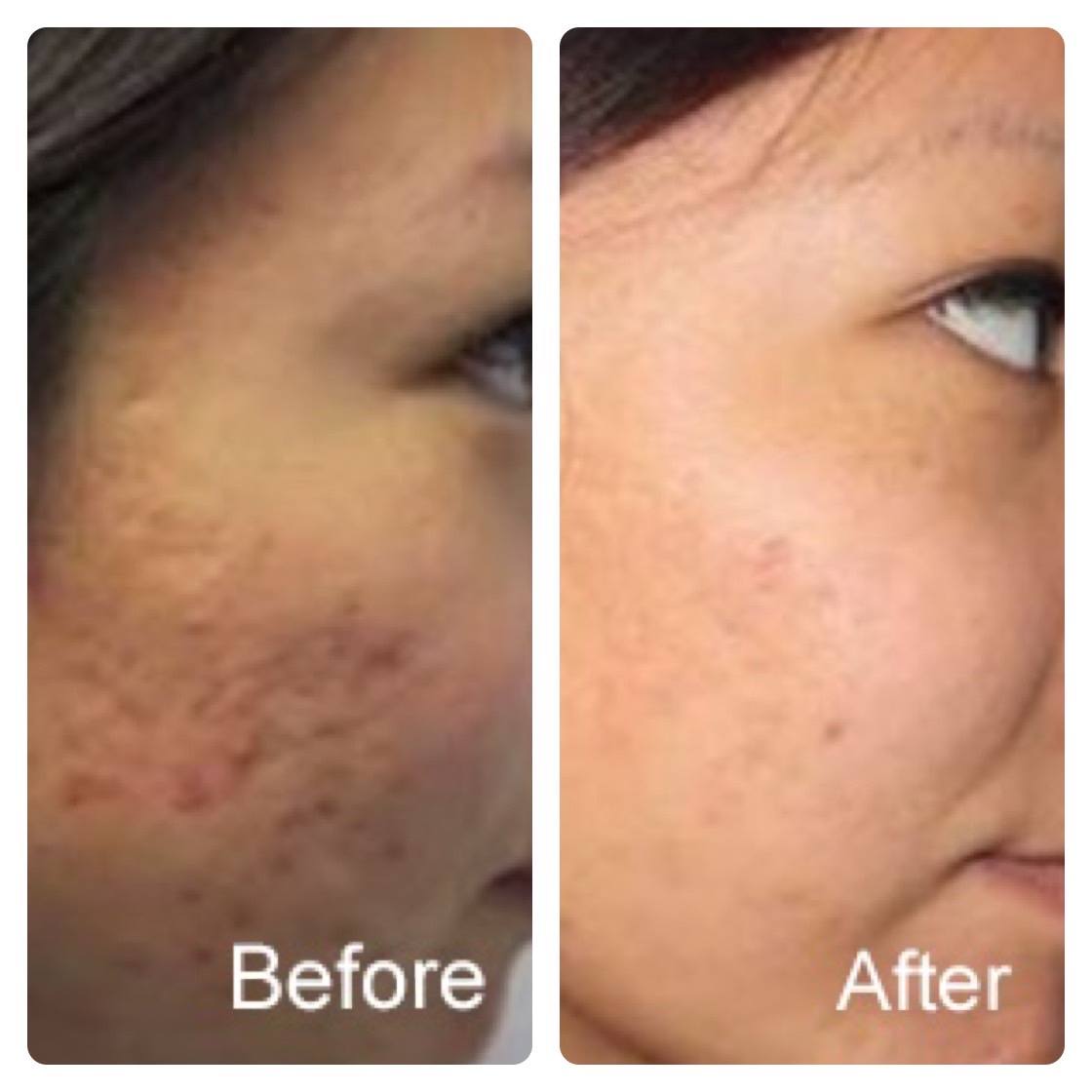 Surgical otoplasty. Honolulu ear surgery to correct cosmetic defects.