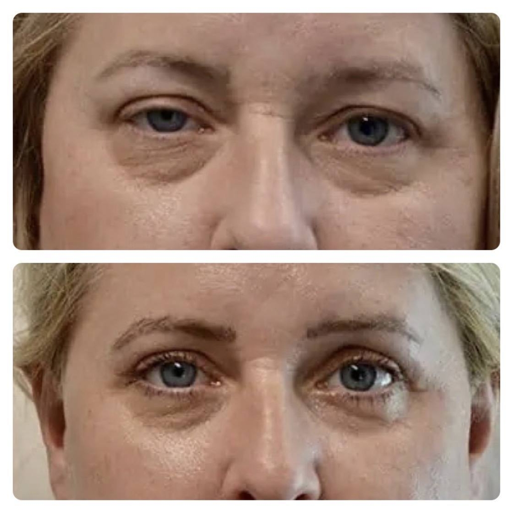 IMG_7698 Neck Lift Procedures in Honolulu