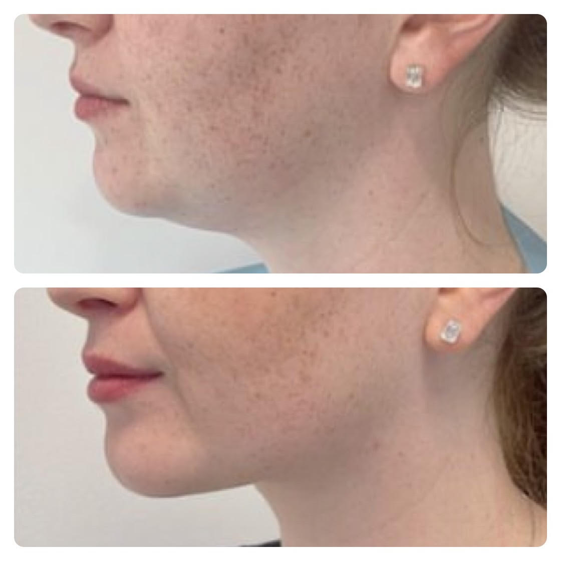 Honolulu Facial Plastic Surgeon for Neck Lifting