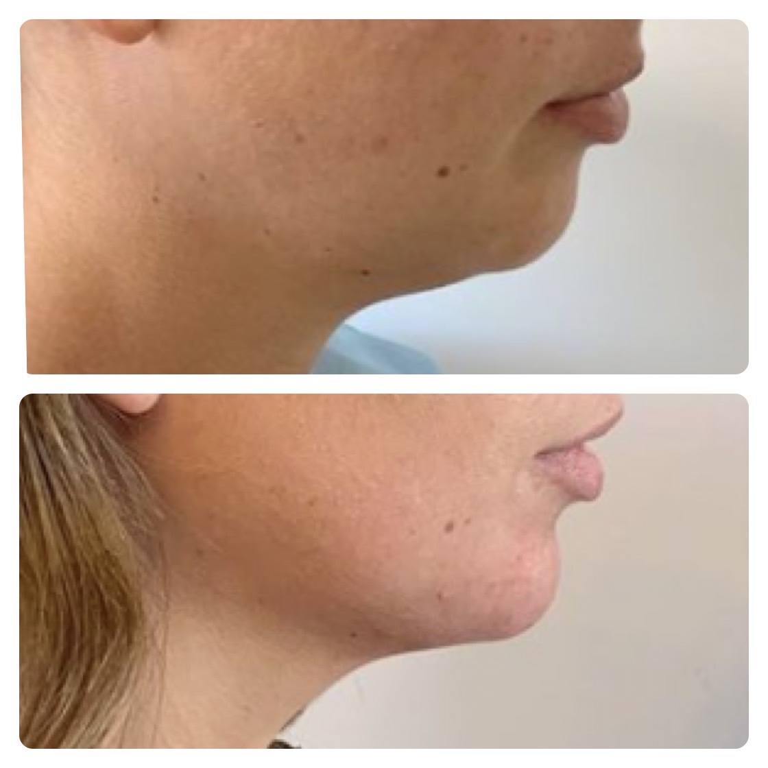 Honolulu Facial Plastic Surgeon for Neck Lifting