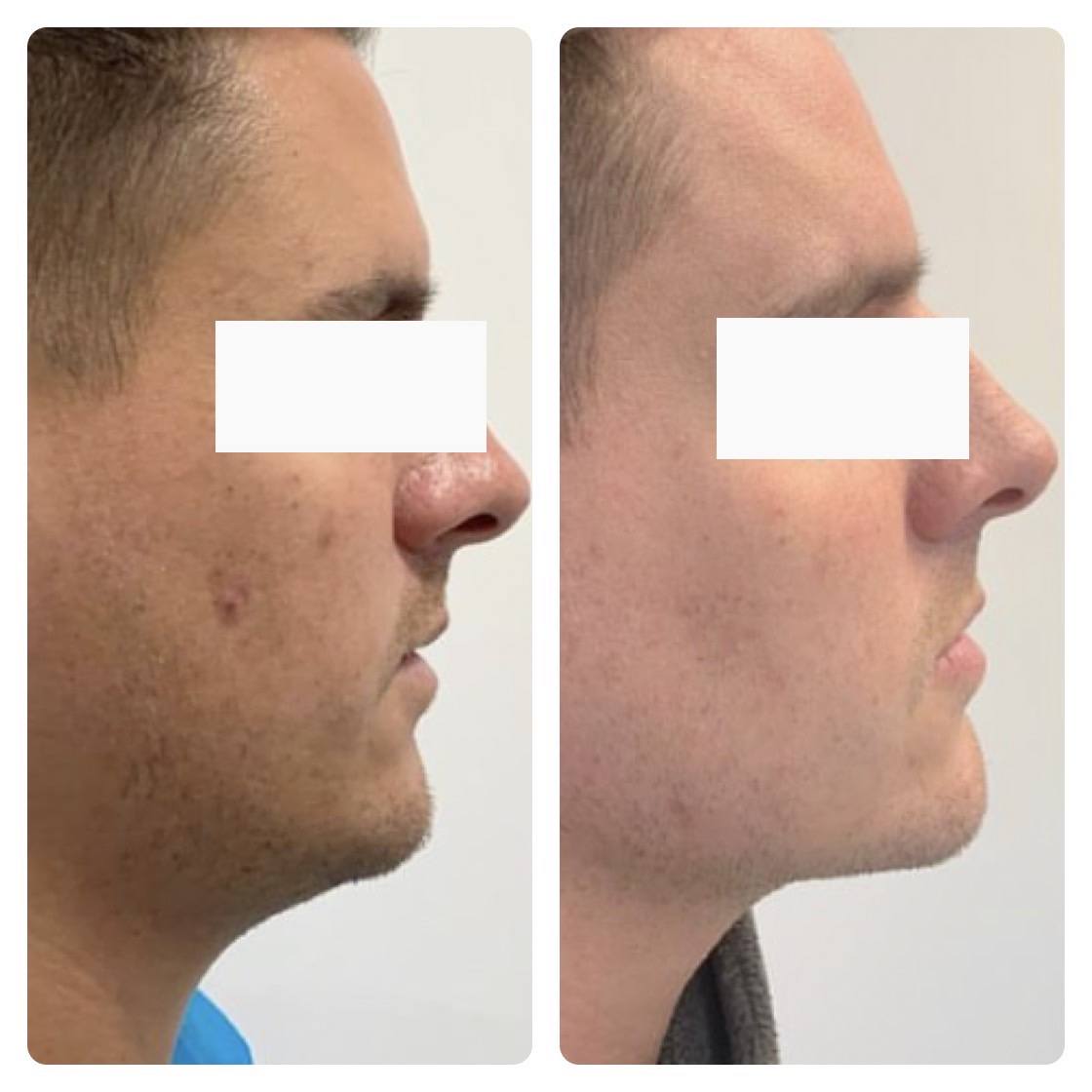 Honolulu Facial Plastic Surgeon for Neck Lifting