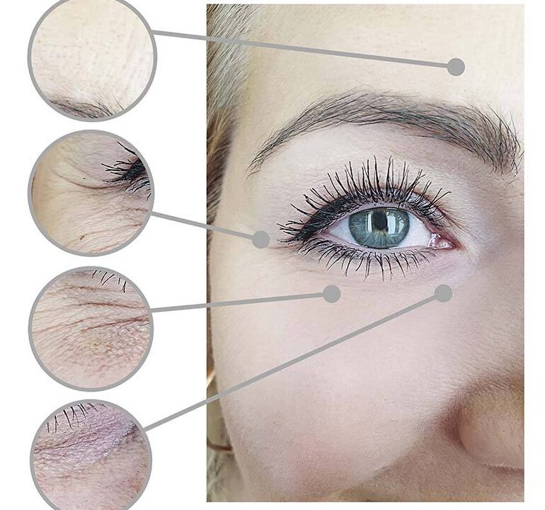 Oahu blepharoplasty, Honolulu. Blepharoplasty facial surgery areas of improvement.