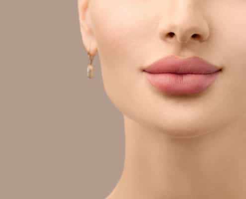 Results of cosmetic lip fillers in Honolulu showcase increased lip volume with improved lip hydration.