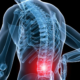 Stem cell therapy for back pain treatment using regenerative medicine techniques at Hawaii Island clinic