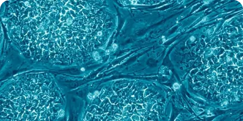 Stem Cell Therapy Human Stem Cells