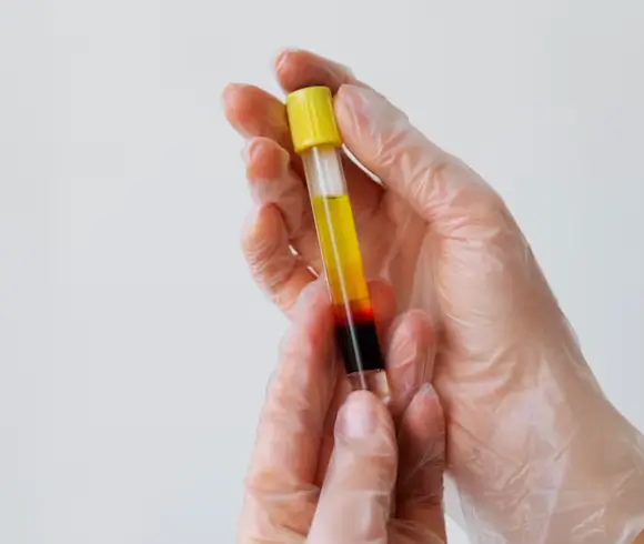 Visualization of key therapeutic proteins in PRP including A2M IGF-1 HGF and fibrinogen