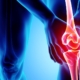 Knee painful - skeleton x-ray, 3D Illustration medical concept.